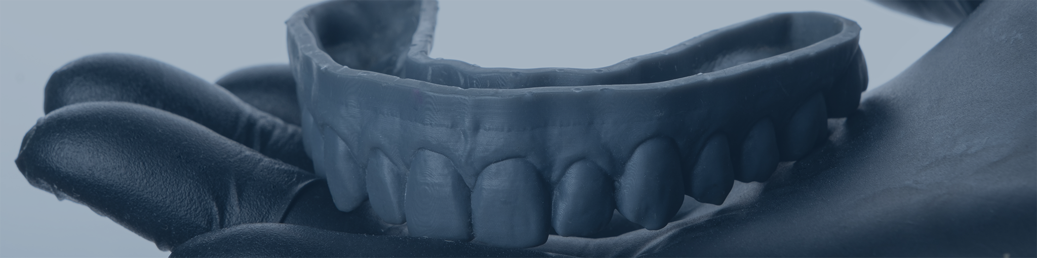 Gloved hand holding dental impression