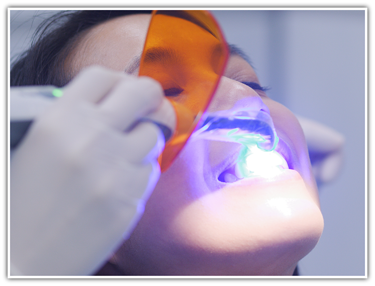 Dental patient having dental bonding performed