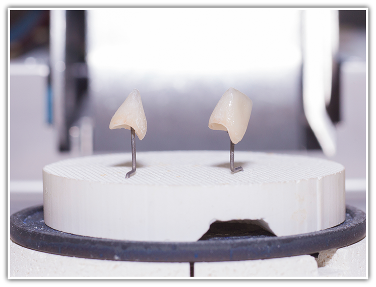 Two ceramic dental crowns on a stand