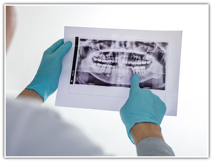Dentist looking at X-ray of teeth