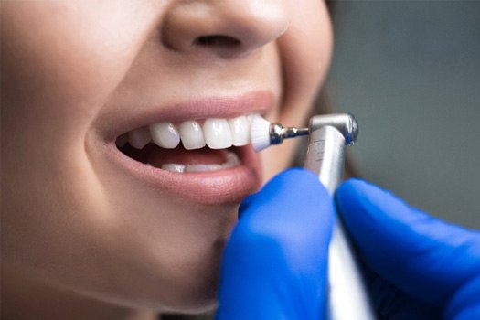 A woman getting a dental cleaning near Westlake
