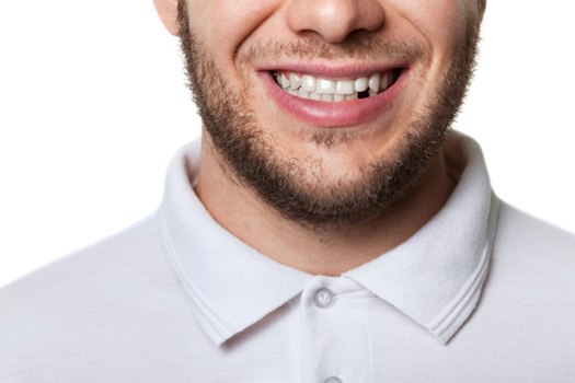 A man missing a tooth near Westlake