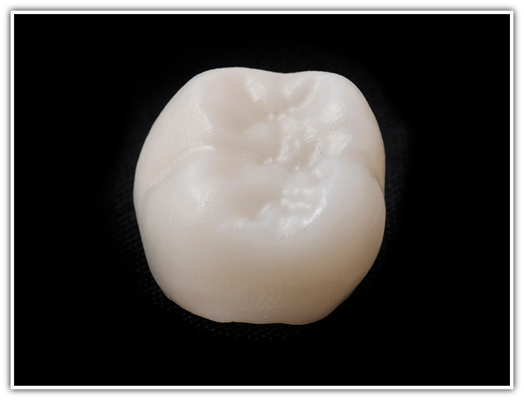 Close-up of dental crown on black surface