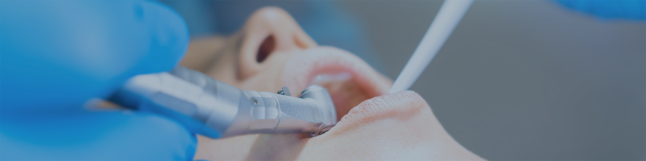 Close-up of patient's mouth during dental treatment
