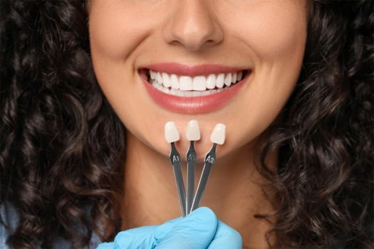 Close up of dentist comparing three dental veneers to a patient’s teeth