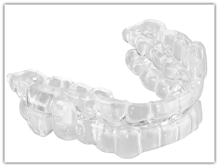 Close-up of oral appliance for sleep apnea