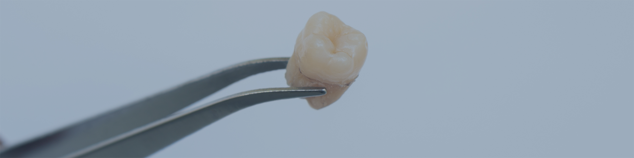 Close-up of extracted tooth held by metal instrument